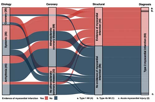 #OriginalResearch: #DEMAND_MI 1st prospective study to undertake systematic cardiac imaging in patients with type 2 MI. Results show high prevalence of LV dysfunction &amp; CAD <a href="/damini_dey/">Damini Dey</a> <a href="/imagingmedsci/">imagingmedsci</a> @marcdweck <a href="/jdinaus/">John Hung</a> <a href="/andabularga/">Anda Bularga</a> <a href="/RyanWereski/">Ryan Wereski</a> <a href="/chapdoc1/">Andrew Chapman</a> ahajournals.org/doi/10.1161/CI…
