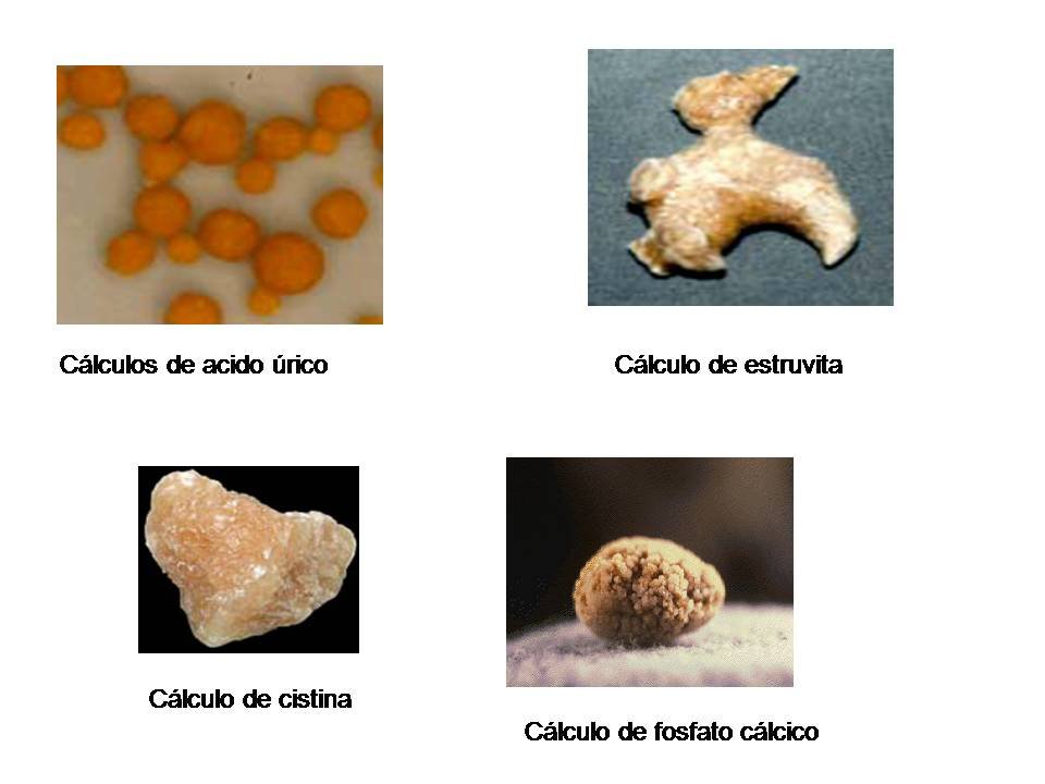 Acido urico cetosis