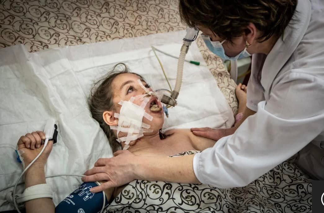 avalaina's tweet image. This is 11-year-old Milena from Mariupol. She was shot in her face at a Russian checkpoint. On the second photo also Milena a week later. The girl is much better and wants to return to gymnastics. CNN came to hospital and made a report about her
#RussianWarCrimes