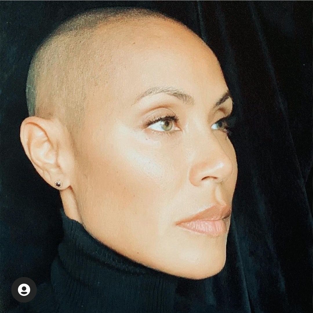ADRIANAAZZIAS's tweet photo. TODOS HABLAN DE LA VIOLENCIA DE WILL SMITH por defender a su esposa, pero la VIOLENCIA VERBAL de Chis Rock no tiene excusa, su abuso verbal contra Jada burlándose de su alopecia es realmente imperdonable, agresiva e inhumana... https://t.co/oOdo5EiyaS