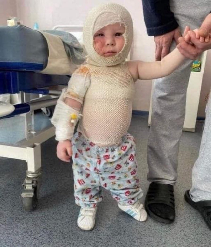 No words can describe how wrong this picture is…This innocent toddler is a victim of Russia’s indiscriminate bombings of civilians.