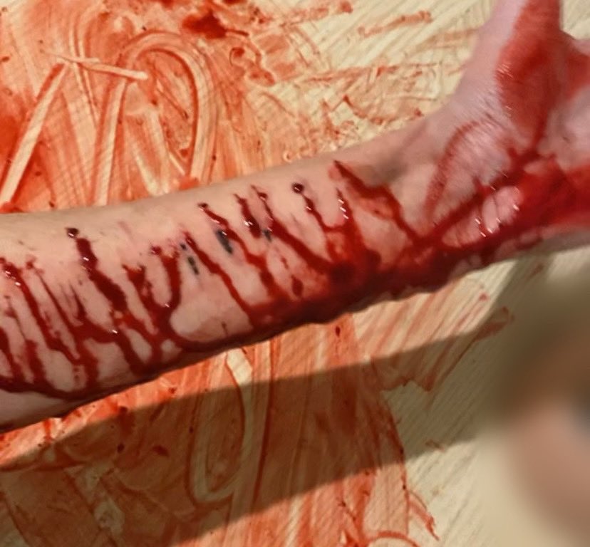 letsgototherapy's tweet photo. selfharm blood :) https://t.co/oYYfcP66rf