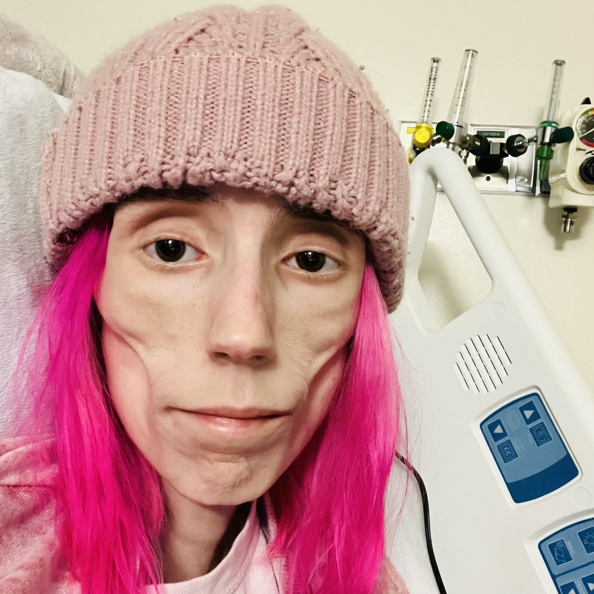 PixieStrmDesign's tweet photo. When I 1st admitted myself to MUSC a month ago vs. NOW https://t.co/t0UEyuePm2