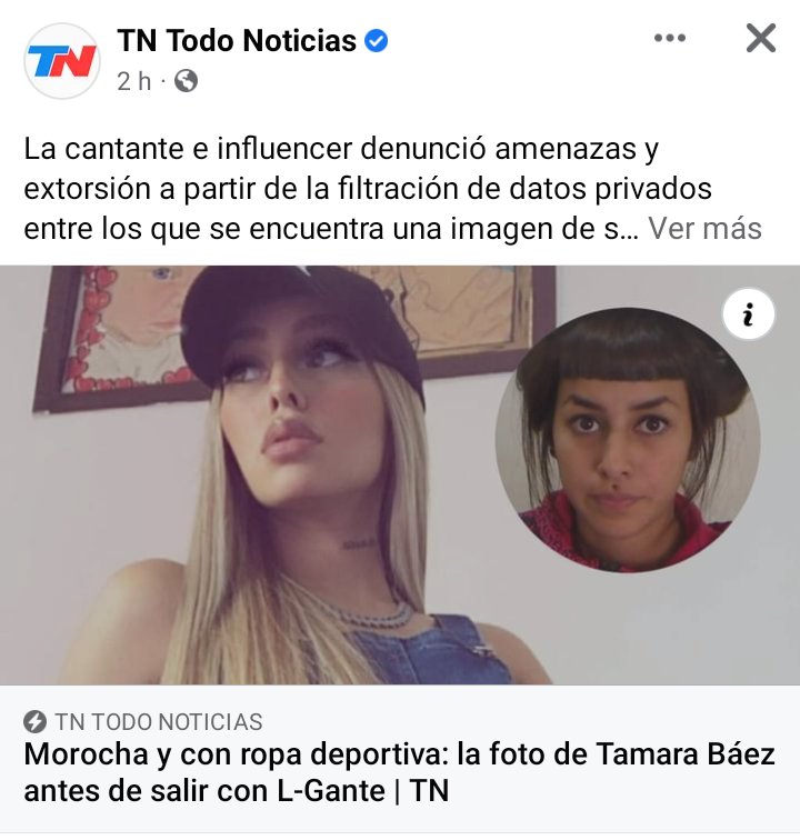 marcelabguerra's tweet photo. No se puede , tanta cirugía. No sos linda  tenés $$$ igual exagerado 😂😂😂😂😵‍💫 https://t.co/sTWy14ukxH