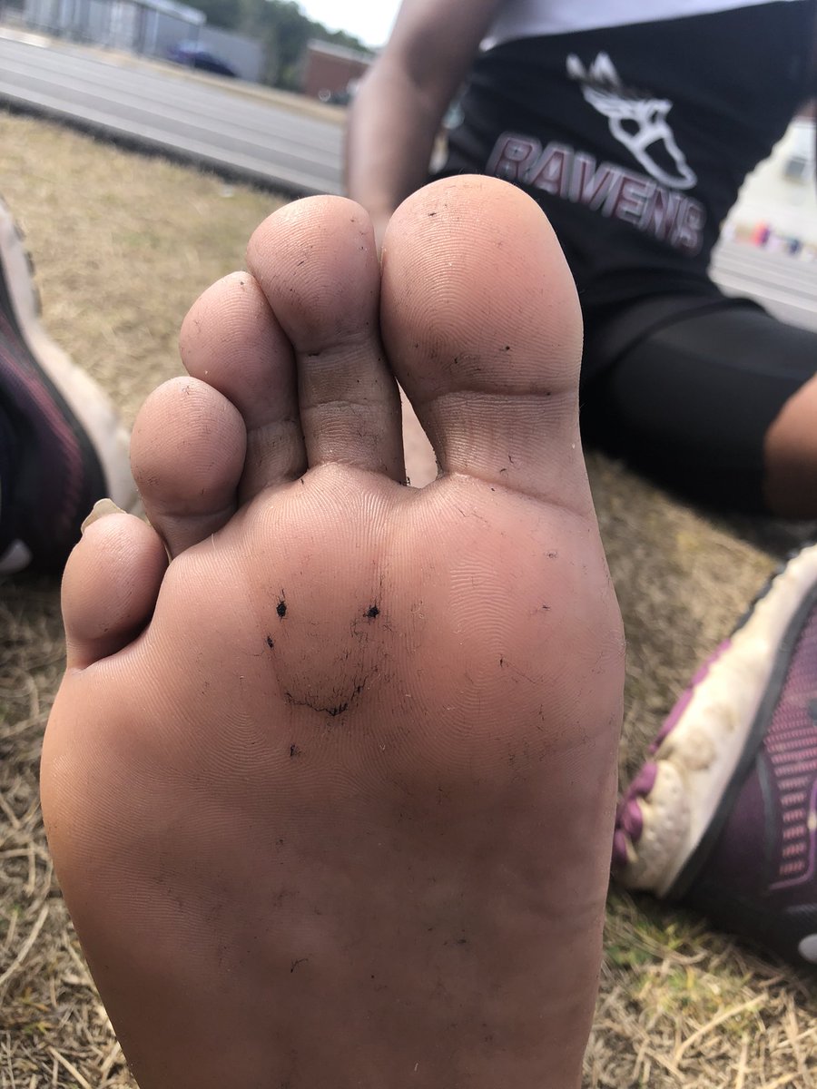 Brooke Kistner (@grammarnerd23) on Twitter photo First track meet of the season. This athlete’s sock fuzz summed it up. <a href="/EdmsRavens/">edms_ravens</a> @Mr_King_EDMS #oneccps #everyraveneveryday_edms First track meet of the season. This athlete’s sock fuzz summed it up. <a href="/EdmsRavens/">edms_ravens</a> @Mr_King_EDMS #oneccps #everyraveneveryday_edms