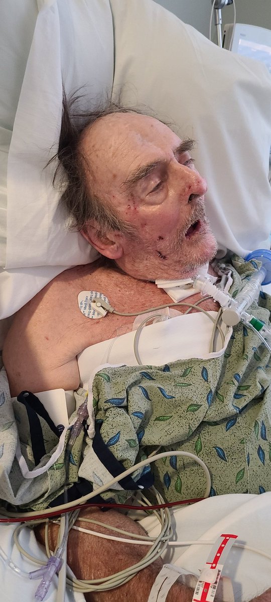 Smirklin's tweet photo. The hospital should be disconnecting Dad tomorrow at approximately 10AM. Not sure how long it will take him to go. Please pray that he will go peacefully and that he will be able to rest. Please also donate if you can, and share either way. #HouseKerklin  https://t.co/qfeqwQUO2R https://t.co/InQxCu7SN1