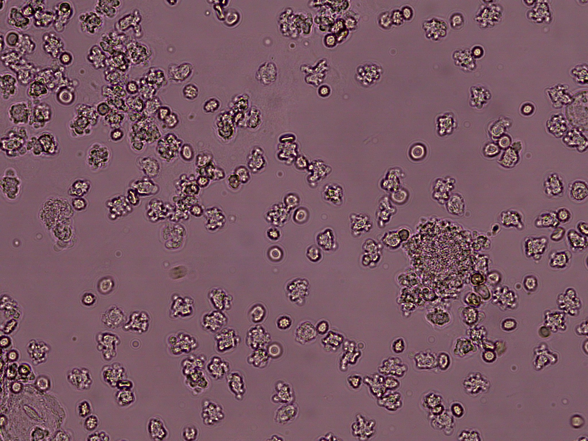Jeffrey William on Twitter "Crowdsourcing a urinesediment. Young