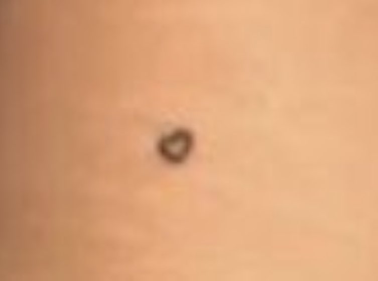keelygotbones's tweet photo. is this a tatt or just a really cool birthmark https://t.co/lESqp0XnXu