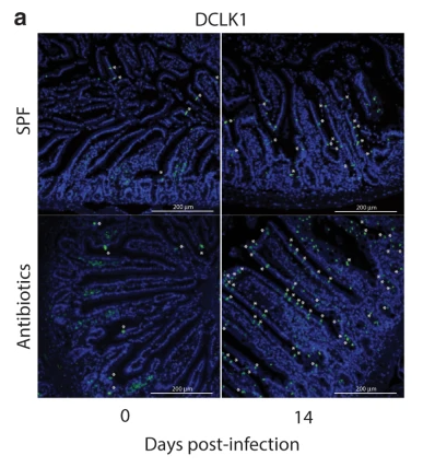 Ben Marsland (@benjmarsland) on Twitter photo Type 2 inflammation is critical to control helminths, or is it? A new study by <a href="/Nicola_L_Harris/">Nicola Harris</a> & team shows that even with a full-blown type 2 response, the gut microbiome is required to stimulate the ENS, increase intestinal motility and clear infection rdcu.be/cI8AV Type 2 inflammation is critical to control helminths, or is it? A new study by <a href="/Nicola_L_Harris/">Nicola Harris</a> & team shows that even with a full-blown type 2 response, the gut microbiome is required to stimulate the ENS, increase intestinal motility and clear infection rdcu.be/cI8AV