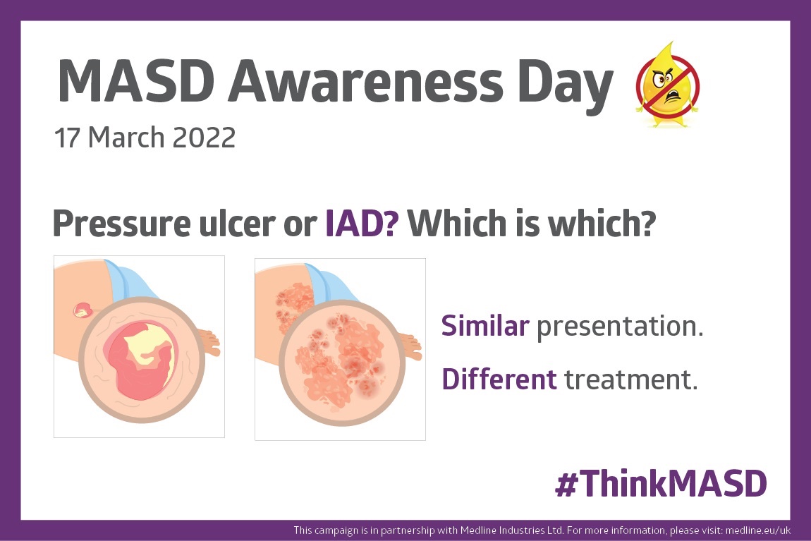 NHSLPDC's tweet photo. Do you know the difference between pressure damage and moisture damage?? Watch the Tissue Viability teams webinar to find out more https://t.co/AKXZJpIR7B #ThinkMASD #ThinkSSKINS #TEAMTVNNHSL https://t.co/xIc1v33UVN