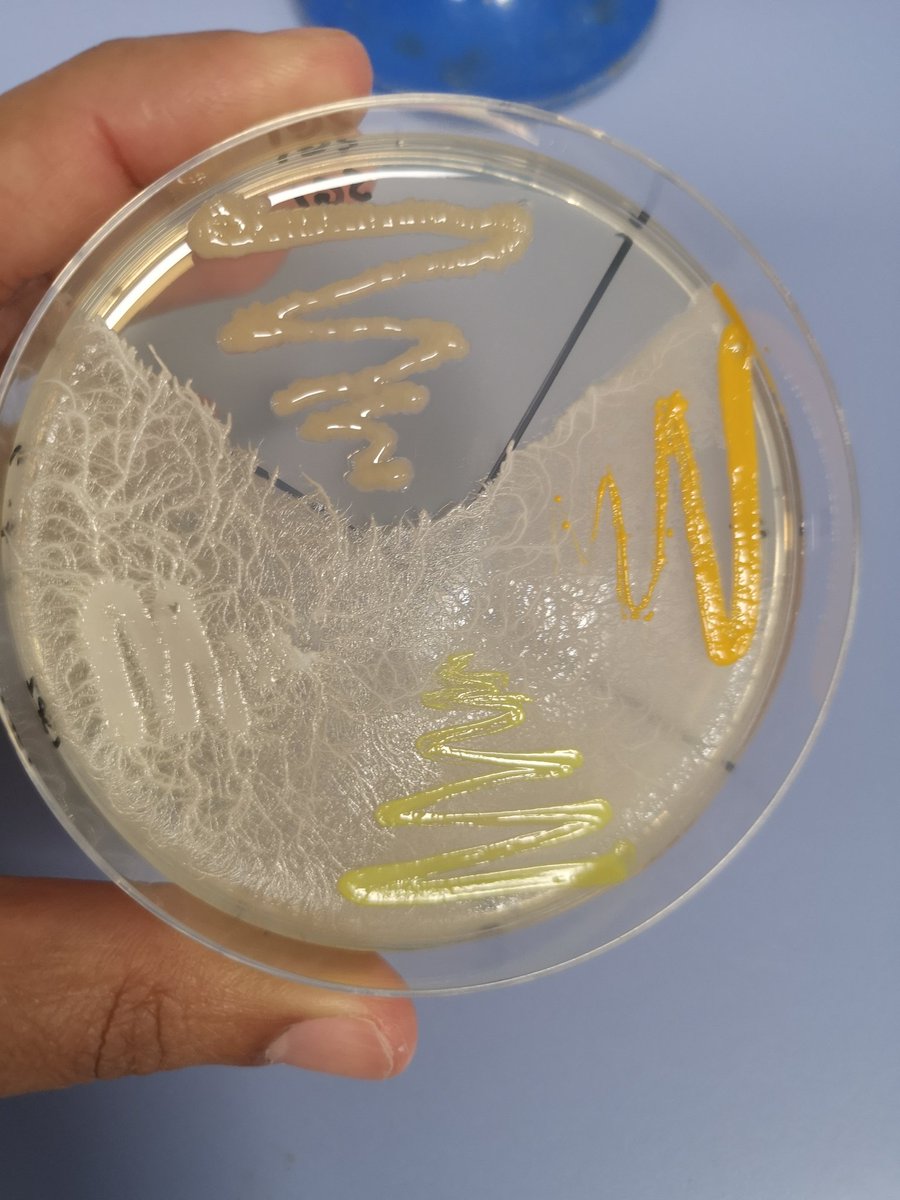 noresearchgrant's tweet photo. When one of your isolates decides to colonise an agar plate and another isolate stands its ground: https://t.co/P0GO7v1bsm