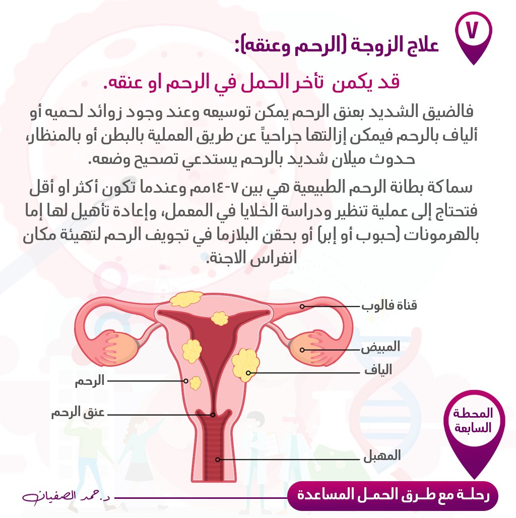 AlsufayanHamad's tweet photo. 7⃣ علاج الزوجة (الرحم وعنقه).
قد يكمن تأخر الحمل في الرحم او عنقه.
فالضيق الشديد بعنق الرحم يمكن توسيعه وعند وجود زوائد لحميه أو ألياف بالرحم فيمكن إزالتها جراحياً عن طريق العملية بالبطن أو بالمنظار، حدوث ميلان شديد بالرحم يستدعي تصحيح وضعه. https://t.co/U1zTFIv2r2