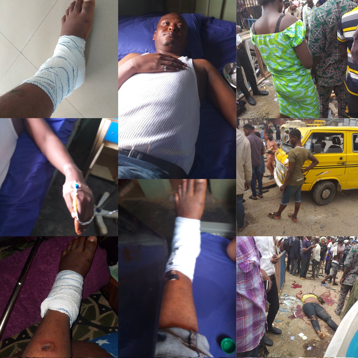 Oluwasuccess's tweet photo. It's was just God that saved my life last year March 16 2021.
Walahi I am a living testimony bcos the accident took 3 lives, may their souls rest in peace but God saved my precious life & I will continue to be thankful to my creator, God Almighty🙏
#GratefulMe
#ThankfulHeart https://t.co/UjQ024bUkr