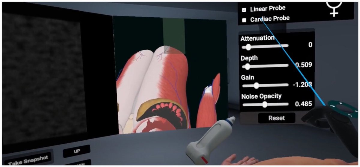 Berci's tweet image. This is simply amazing! An ultrasound simulator in #virtualreality!

3D Organon is the first software platform in the world that releases an ultrasound simulator in #VR that does not require a mannequin or a special probe. 

The VR controller acts for the ultrasound probe.