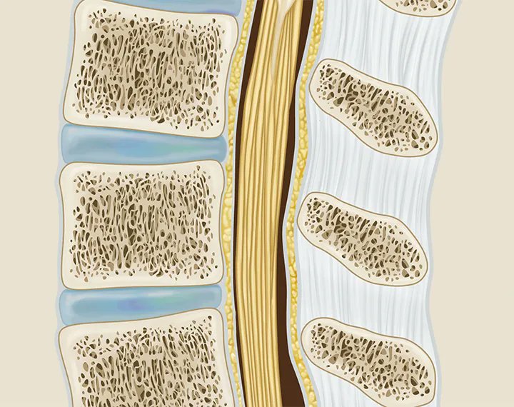 I love doing this cancellous bone texture. It's so satisfying!

Detail from a spinal illustration for the University of Michigan Department of Radiology.

#medicalillustration #digitalillustration #spine #spinalcord #sciviz #biomedicalvisualization #biomedicalart #medicalart