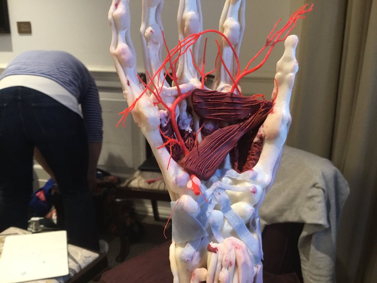 consultantPT's tweet photo. Great CPD @SurgicalSculpt   The hand is coming together .... a must if your a physio or medic interested in the  hand and want to learn in a relaxed environment https://t.co/ifisH6mROy