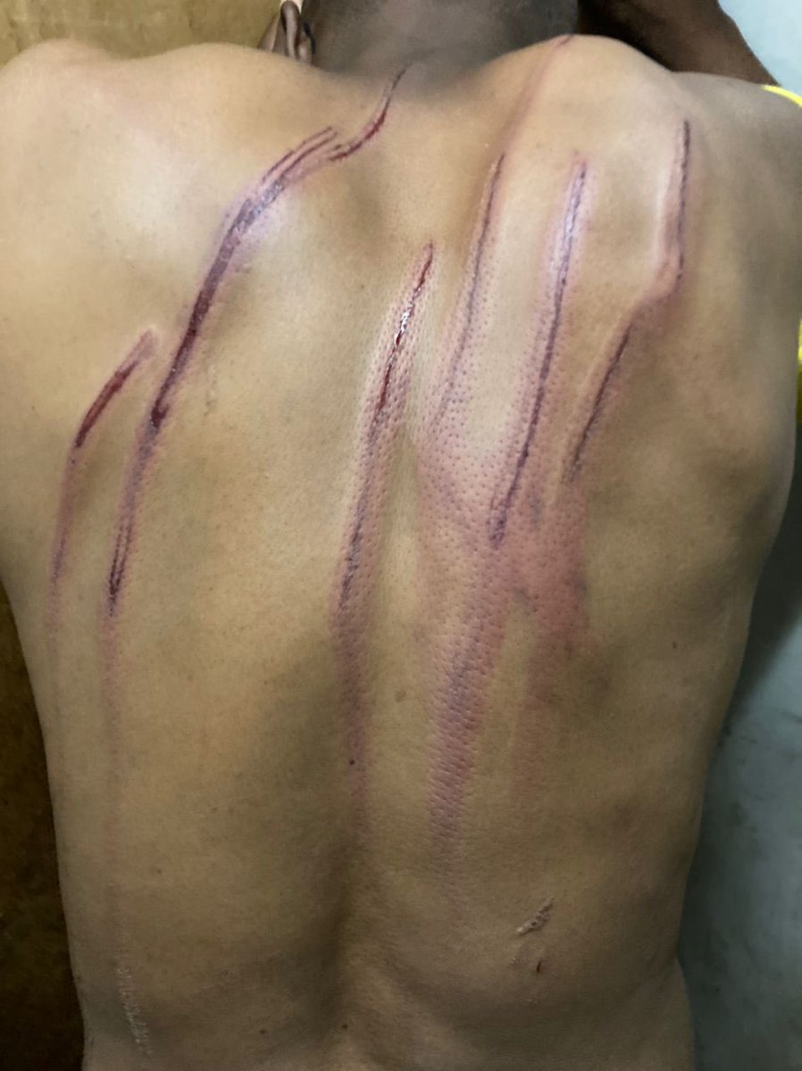 daddyhope's tweet image. This is what Zimbabwean @PoliceZimbabwe did to main opposition @CCCZimbabwe supporter, MadziBaba veShanduko, real name Godfrey Karembera.

He was tortured for wearing his Yellow Regalia and for encouraging citizens to vote for @nelsonchamisa

They said it was disorderly conduct!
