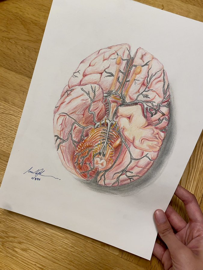 BaseAnakFK's tweet image. Ketika anak dkv kecemplung di FK terus bikin laporan anatomi dok