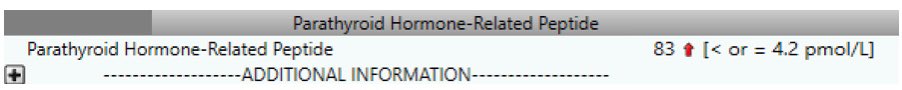 Often hear “I have never found an ⬆️PTHrP in work-up for hypercalcemia” Here is another one: PTHrP = 83 pmol/L
🔑 PTHrP hypercalcemia in malignancy:
- hypercalcemia less responsive to bisphosphonates
- associated with shorter survival 
#OncoNephrology