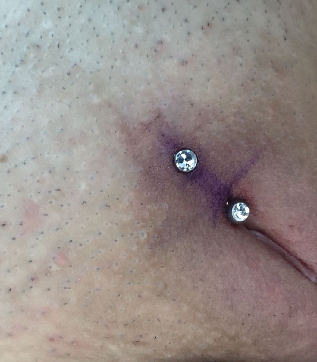 leeidipiercer's tweet photo. Perfuração íntima feminina, feita com agulha Américana e joia em titânio grau implante. https://t.co/hwdXZc1ZEx