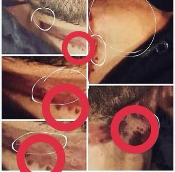 SelfMusingSushi's tweet photo. Kindly compare the condition of ligature mark on SSR's neck.
Source: Textbook of forensic medicine by Narayan Reddy
We want 302
Now nobody can Stop us
Day641 Immortal Sushant
#JusticeForSushantSinghRajput
United Against Bollywood
#BoycottBollywood https://t.co/6jtZcZtq9T
