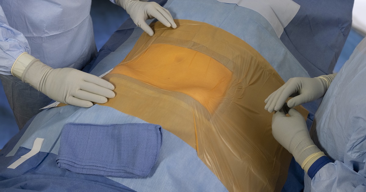 AveryDennison's tweet photo. We're delighted to be partnering with @CardinalHealth to bring the Surgical Incise Drape with CHG, featuring BeneHold™ CHG adhesive technology, to the operating room. Visit Cardinal Health in booth 7231 at #AORN2022 this week to learn more. https://t.co/og7fWTU2gY @ADMedical https://t.co/LzlLbJZeLI