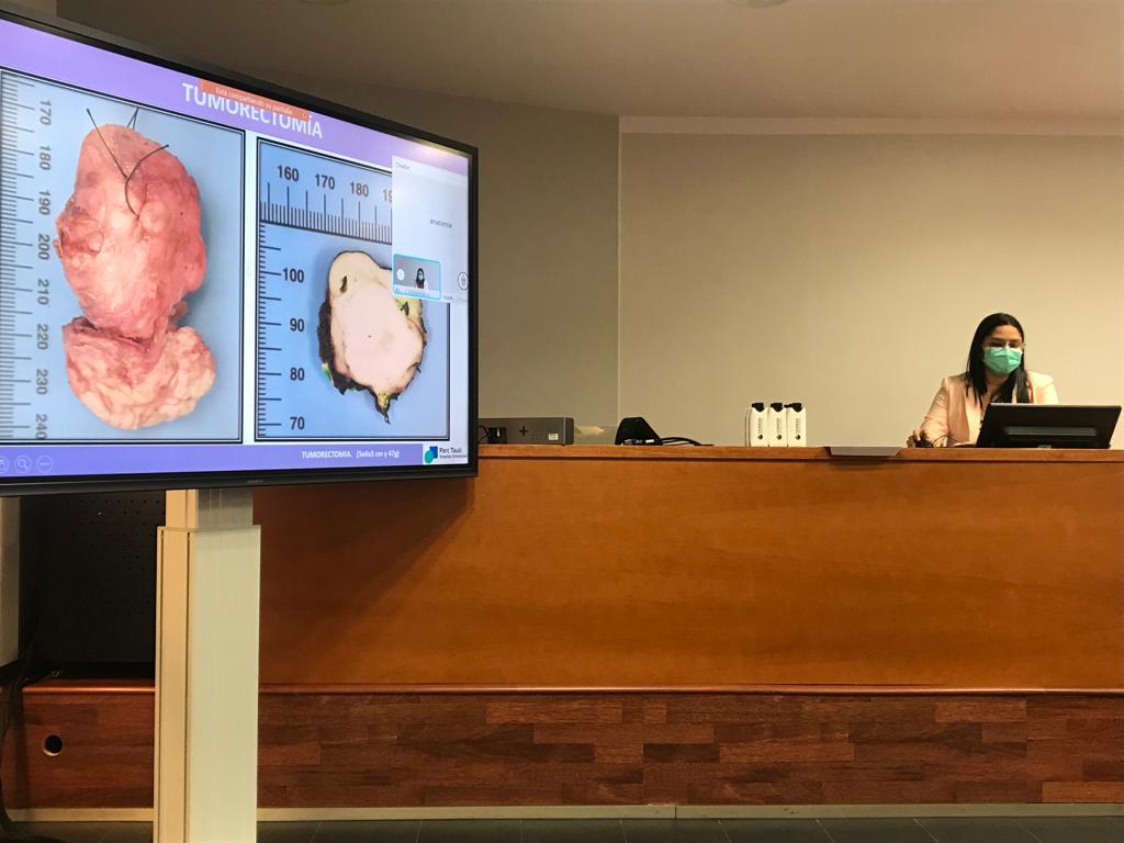 Nuestra R2 Marbeth presentando en la sesión de Patología Mamaria de la <a href="/SCAPSoMe/">SCAP</a>!! Un caso de liposarcoma pleomórfico de la mama!! 🔬Buen trabajo!! 💯
