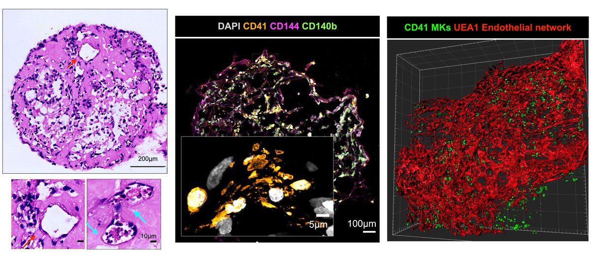 Pleased to present our pre-print: biorxiv.org/content/10.110… where we report the development and application of a BM organoid for the study of hematological disorders. I hope this proves a valuable tool for future studies.