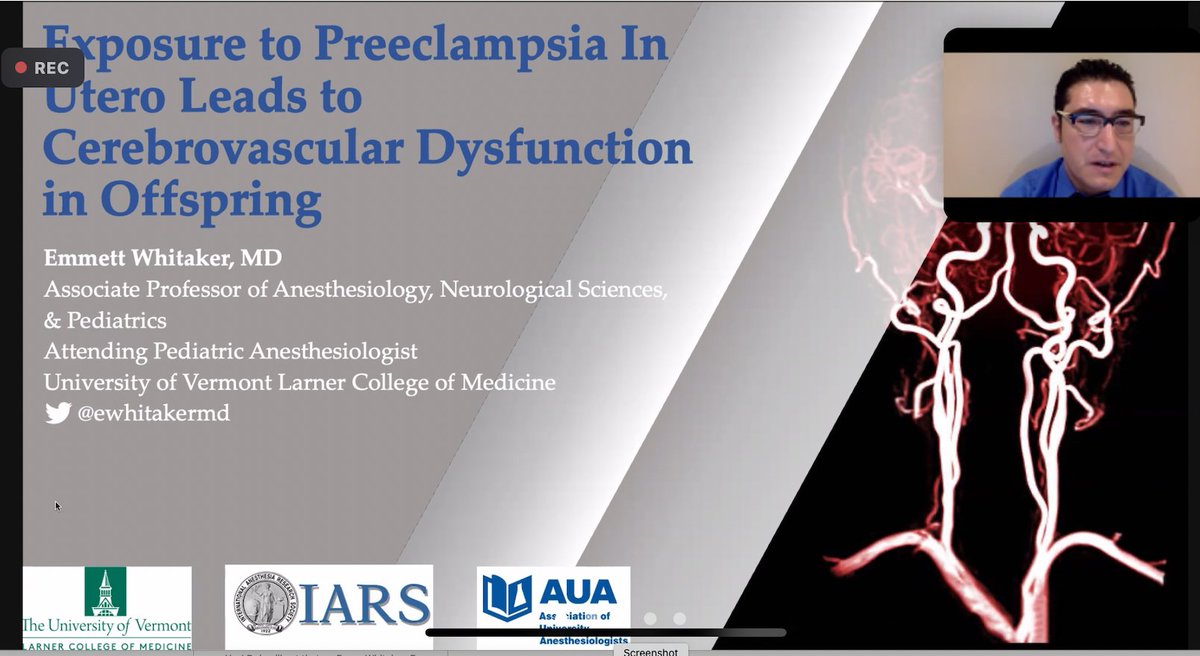 Had a great time presenting our work <a href="/AUA_Anesthesia/">Association of University Anesthesiologists</a>, thanks for the opportunity! <a href="/iars360/">IARS360</a> <a href="/SOCCA_CritCare/">Society of Critical Care Anesthesiologists</a> <a href="/AbbieCJohnson/">Abbie Chapman, PhD</a> @UVMMedCenter <a href="/UVMHeartBrain/">UVMHeartBrain</a> <a href="/UVMLarnerMed/">UVM Larner Med</a> @UVMHealth  #iars22 #socca22 #pedsanes