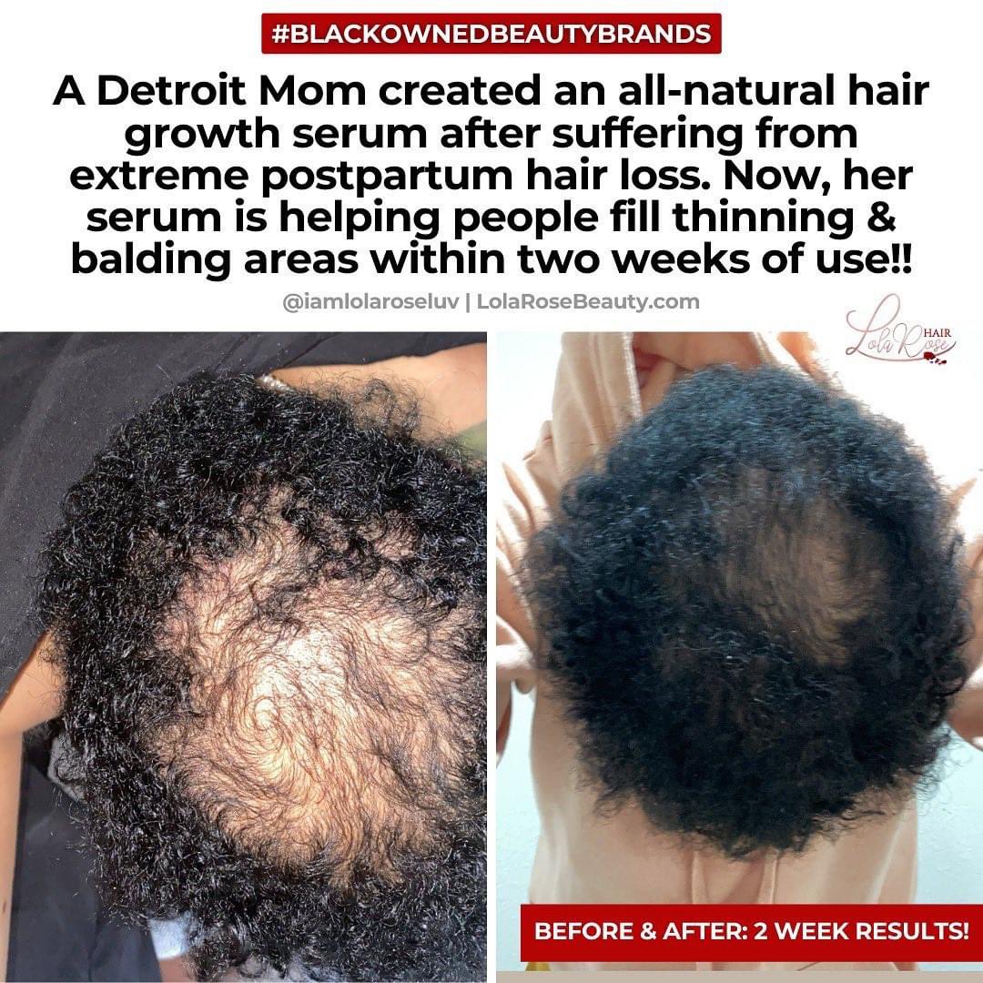 LolaRoseluv's tweet photo. You guys have all weekend to place your order for it to go out with the orders placed during restock day 😊 https://t.co/XFf7XFFtm1 please retweet‼️ #blackbusiness #hairhealth #bettingtips #luckoftheirish https://t.co/f2LCyK5gNH