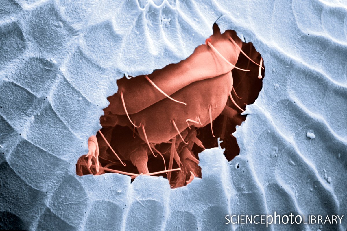 sciencephoto's tweet photo. A hatching egg of the cabbage moth, Mamestra brassicae. 

The picture is a scanning electron micrograph of an egg, hemispherical in shape with a ribbed surface. 

Credit: Dr Jeremy Burgess
https://t.co/BdU5sBV6R3 

#cabbagemoth #caterpillar #larva #moth #larvae #pest https://t.co/vVQfSXxC6x