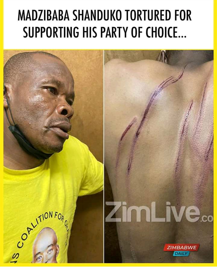 Musvetu1's tweet photo. @ZECzim https://t.co/ywcfK5FRho