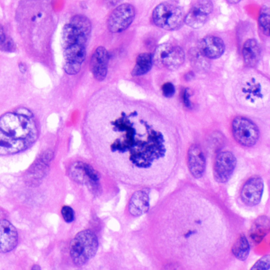 Like if you see a squirrel 🐿 or RT if you see a Charmeleon Pokémon #pathology #mitosis