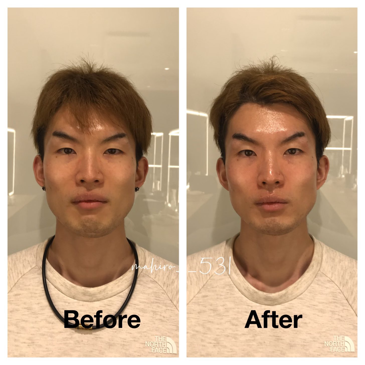 まひろ໒ ﾟエンジェルハンド 90分間小顔美肌トリートメントです お顔変わりすぎて メンズからもまた来ます って言ってもらえるの本当に嬉しい 本当に美意識高い男性が増えたなと 素敵です 美容 小顔 フェイシャル 表参道 T Co
