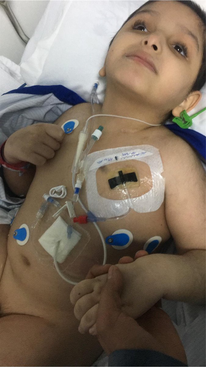 Azooo000oz's tweet photo. اليوم الجمعه ارجوا من كل من تمر عليه التغريدة أن يدعوا لابني عبدالعزيز الجريد بشفاء والعافيه فإنه فقد الذاكرة والنطق والنظر والحركة يعاني من السرطان والجلطات لا تنسو عبدالعزيز من دعاكم تكفون لا تنسو عبدالعزيز من الدعاء@K_binalshikh @MISHALALSAUD19 @afaaa73 #عبدالعزيز_بن_فهد https://t.co/8eWCucktBC