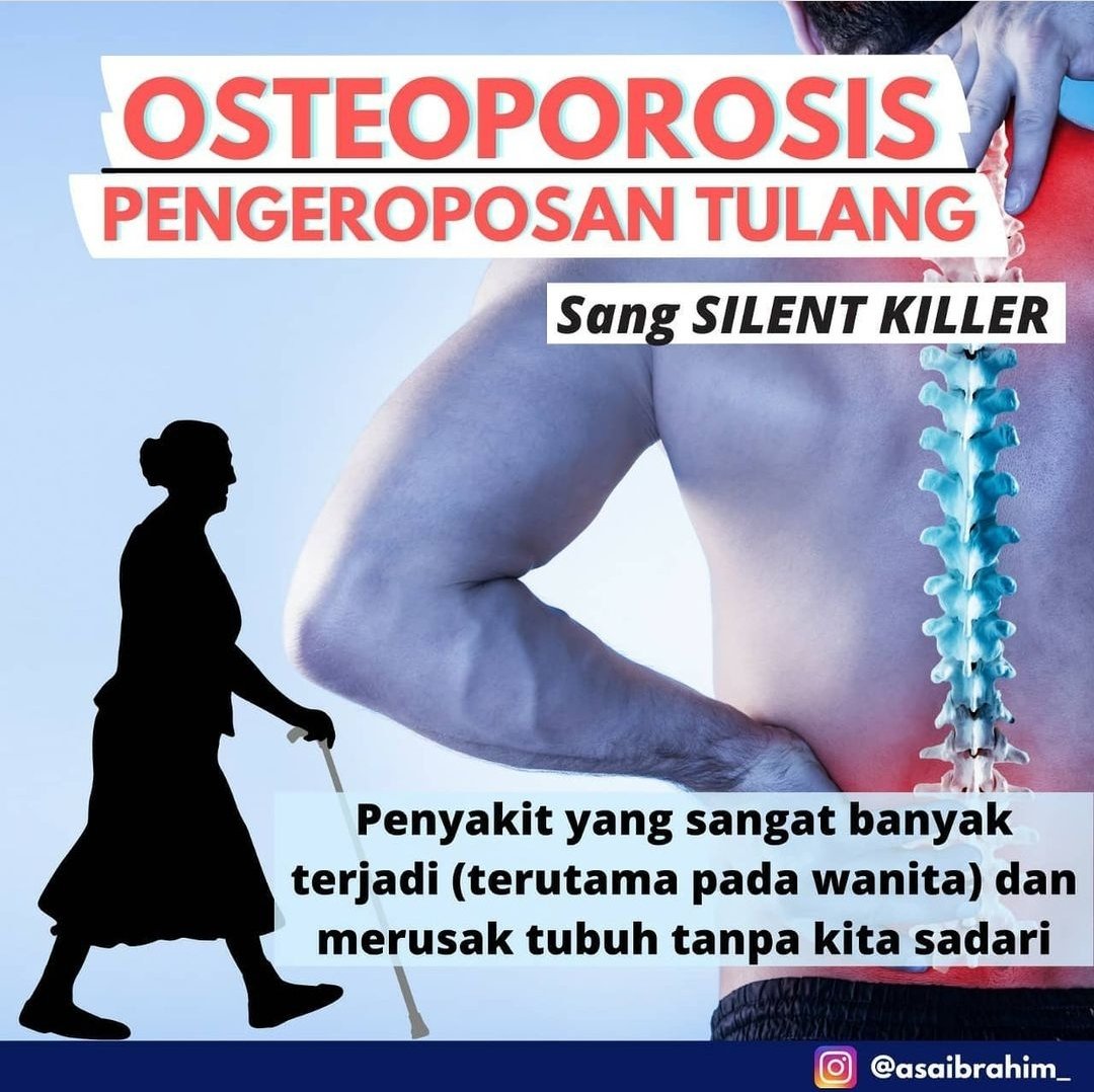Org dgn nyeri di punggung jmlhnya byk bgt, penyebabny mcm2, mulai dr problem tulang,otot,saraf, bhkan kadang organ dlm(ginjal,empedu, dsb)

Yuk kita bahas dikit tntang nyeri punggung.
Biar klo km ad keluhan/sakit,tdk terlambat berobat dan mlh tambah parah.

- utas penting -