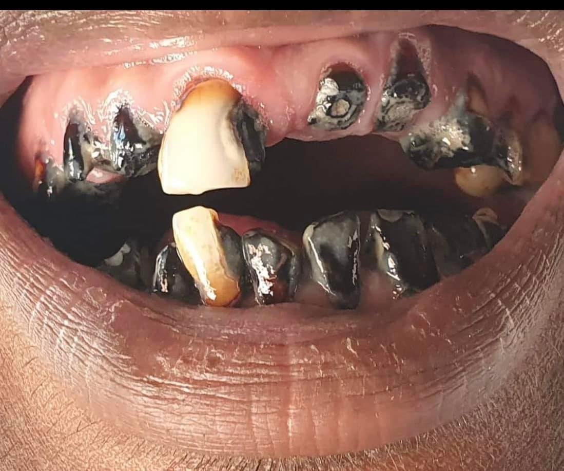 Abukarawale's tweet photo. Qaadka waxay qaraabo dhaw yihiin; jahliga, xanuunka, beenta, tuugnimada, fakhriga, gaajada, iimaan-la'aanta, musuq-maasuqa, Shaqo la’aanta salaad-la'aanta iyo soon la'aanta.
#ISKAJIR https://t.co/1MRtwCwkyO