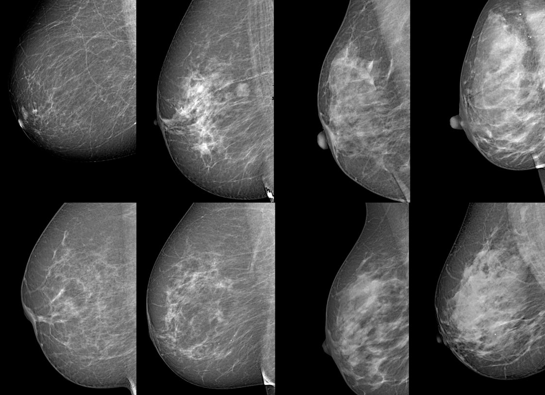 deeptracetech's tweet photo. #TRACE4BDensity on @ScienceDaily 🔝🔝🔝

https://t.co/GfpPFiGTKy

#BreastCancer #BreastDensity #DeepLearning #MachineLearning #Radiomics #ArtificialIntelligence #Personalized #Predictive #Medicine #DIagnosis #Prognosis #Oncology https://t.co/RanOQ4Tb4S