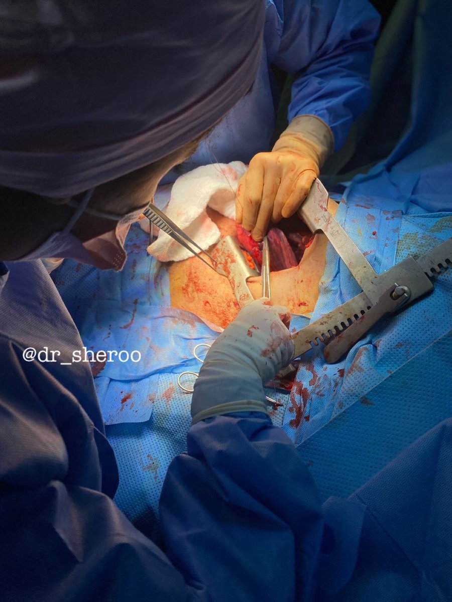 Dr_sheroo's tweet photo. I had the honor of suturing a beating heart in a life saving thoracotomy the other day!, this is the highlight of my residency so far, it was such a magnificent view so thankful for the opportunity 
سبحانك ربي ما اعظمك https://t.co/eI2vcSDNdU