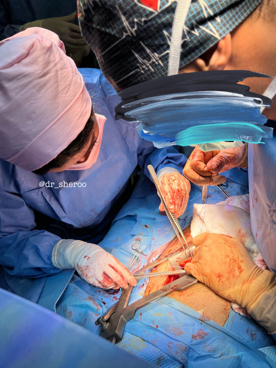 Dr_sheroo's tweet photo. I had the honor of suturing a beating heart in a life saving thoracotomy the other day!, this is the highlight of my residency so far, it was such a magnificent view so thankful for the opportunity 
سبحانك ربي ما اعظمك https://t.co/eI2vcSDNdU