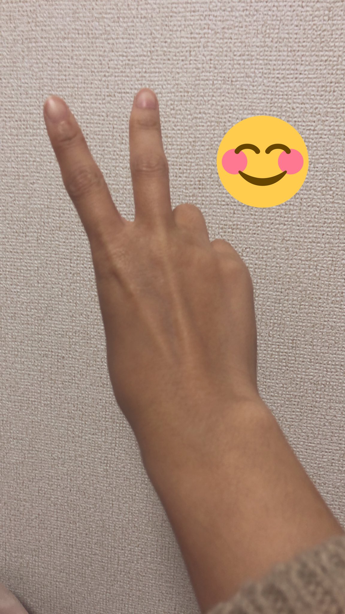 Remi やっとこさ ギプス取れましたー ひゃっほーい 明後日のqc検定 間に合いました涙 T Co Qwddyiaku0 Twitter