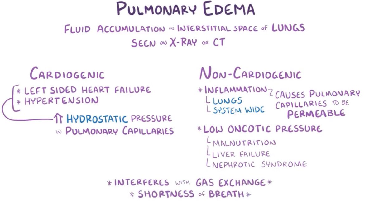 DailyPharmacist's tweet photo. ACUTE PULMONARY OEDEMA INITIAL MANAGEMENT 🫁

“Pour SOD”

• Pour away (stop) IV fluids
• Sit patient up
• Oxygen - if saturation <95%
• Diuretics - furosemide 40mg IV stat

💡 Other treatments in severe oedema include IV morphine, CPAP &amp; inotropes https://t.co/pgB8inTzIJ