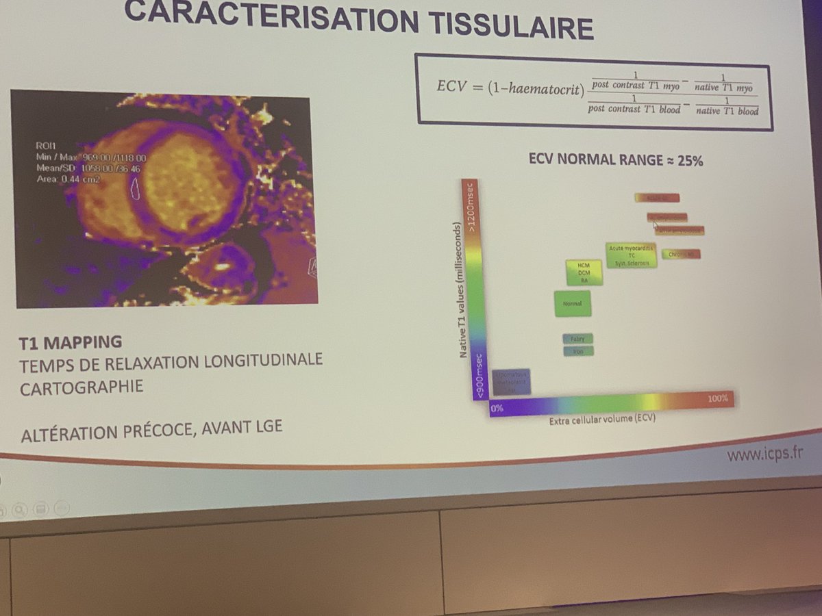 SABOURETCardio's tweet photo. T1 mapping and diagnosis of #HF ⁦@CNCFCardio⁩ #CNCFCongress https://t.co/t26jmw43kf
