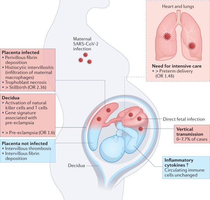 NatRevImmunol's tweet photo. SARS-CoV-2 infection and COVID-19 vaccination in pregnancy https://t.co/oKVWAu5pmi https://t.co/oPaNW8LydP