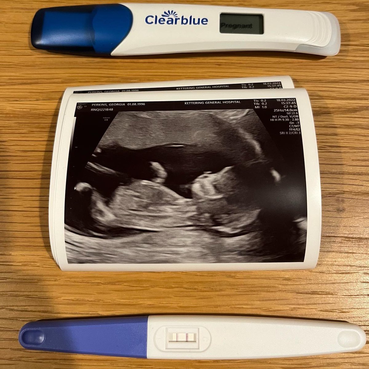 geeperkins_'s tweet photo. So me and Aiden have been keeping a little secret we can now finally tell! Baby Perkins due September 2022💙💗 
We’re both so excited for this next chapter of our lives✨

And of course Daddy had to buy him/her their first football shirts😂 @PerkinsAiden 🥰 https://t.co/h6hu4Fua2j