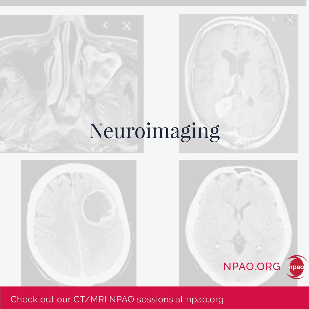 NPAOntario's tweet photo. π’ CT/MRI Scope of Practice Changes Coming July 1st
Are You Prepared?
Check out our NPAO sessions at: https://t.co/96RtWijxkS
Stay Tuned: Additional Training Opportunities Will Be Announced Soon!
βοΈ NPAO Members get FREE access
#NPAO #NPtraining #CTMRI #NPeducation https://t.co/XqN6ySD32L