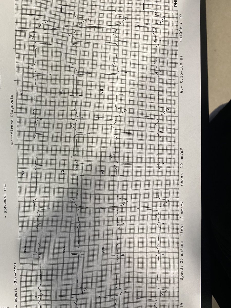 DrMRast's tweet photo. Advise from the hive mind on SOO?
#EPeeps https://t.co/TFKX3byNL2