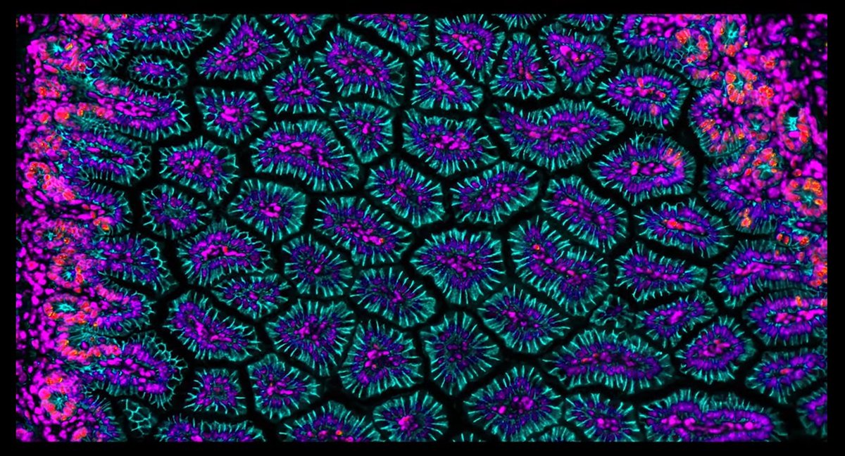 RogisterDe's tweet photo. ⚠️Nos #cellules comme vous ne les avez sûrement jamais vues 🔎🔬!
#neurologie #immunologie #mitose #SVT

🎬 Un documentaire exceptionnel entre #sciences &amp; #art 🤩

Bravo à toute l'équipe @cellworlds_off @LePourpre &amp; al ! 

👀 à regarder ! 
#TeamSVT  
⬇️
https://t.co/hpkSYIBOee https://t.co/egpHwnDg2F