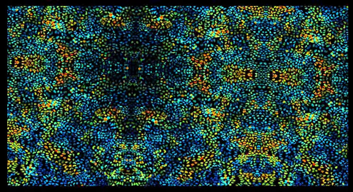 RogisterDe's tweet photo. ⚠️Nos #cellules comme vous ne les avez sûrement jamais vues 🔎🔬!
#neurologie #immunologie #mitose #SVT

🎬 Un documentaire exceptionnel entre #sciences &amp; #art 🤩

Bravo à toute l'équipe @cellworlds_off @LePourpre &amp; al ! 

👀 à regarder ! 
#TeamSVT  
⬇️
https://t.co/hpkSYIBOee https://t.co/egpHwnDg2F
