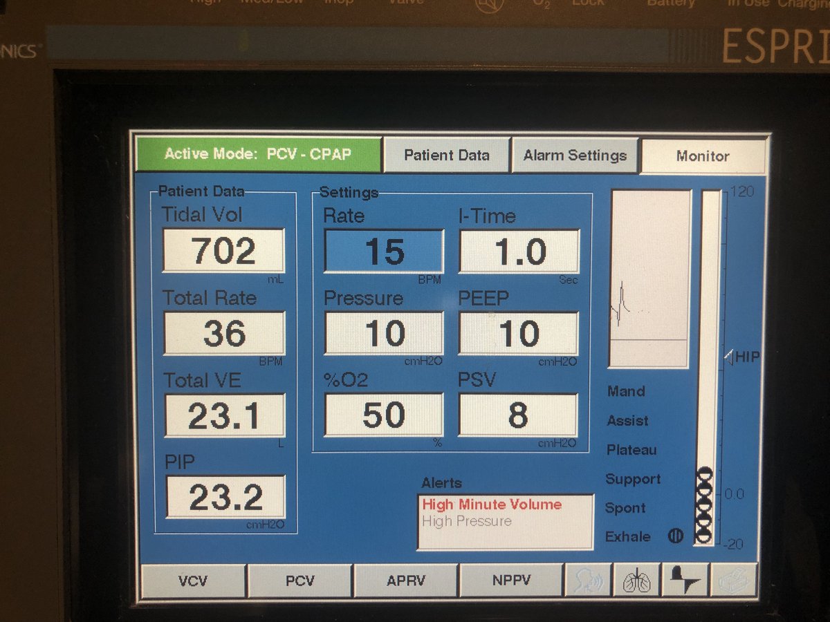 ICU stories: You start your night shift and while walking in and out each patient’s room, you see th...